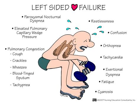 symptoms of left sided heart failure